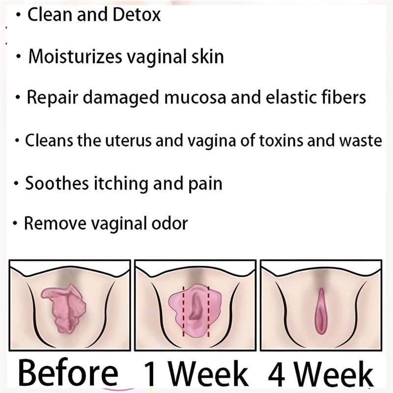 tsoneoo Dexcara Detox Repair - Natural Repair Vagianal Capsules, Natural Repair Vajinal Capsules, Firming Repair & Pink and Tender Natural Capsules,Stay Clear & Fresh（10pcs）