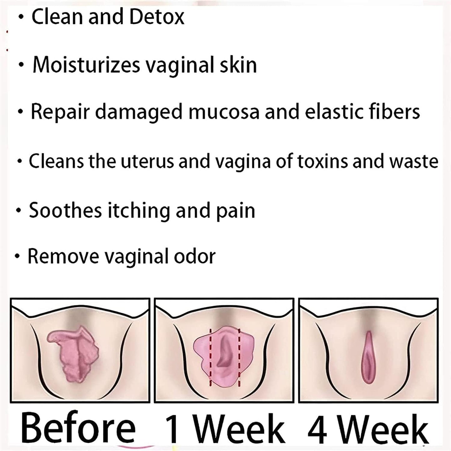 EXGYAN Annie Care Capsulas, Annie Care Capsulas, Pink and Tender Natural Capsules, Stay Clear & Fresh,Annie Care Capsulas 1