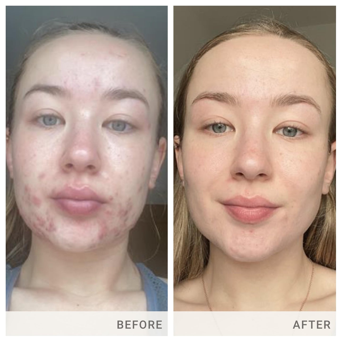 Advanced Nutrition Programme Skin Accumax Supplement distributed by jane iredale, 90-day supply