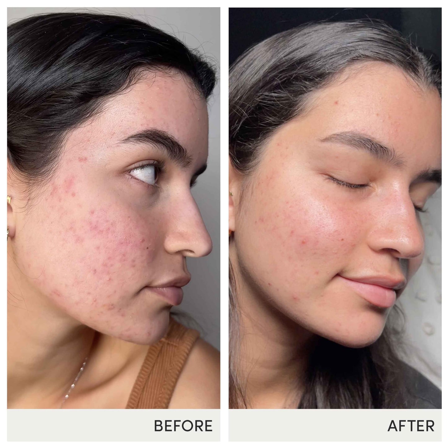 Advanced Nutrition Programme Skin Accumax Supplement distributed by jane iredale, 90-day supply