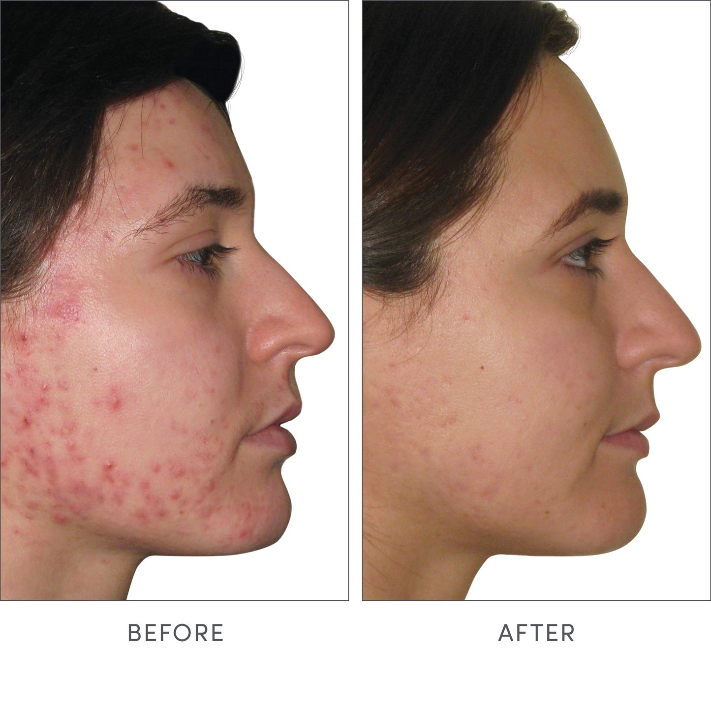 Advanced Nutrition Programme Skin Accumax Supplement distributed by jane iredale, 90-day supply
